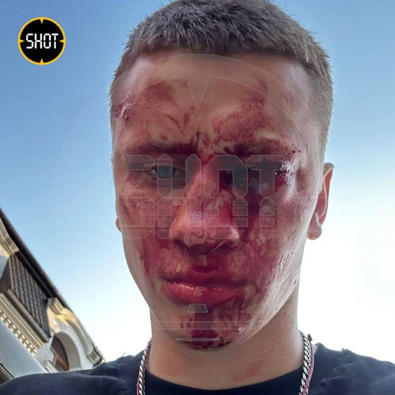 Чемпион России и Европы по боксу лишился глаза, заступившись за парня, которого жестока избивала толпа ублюдков в Крыму Чемпион России и Европы по боксу лишился глаза, заступившись за парня, которого жестока избивала толпа ублюдков в Крыму