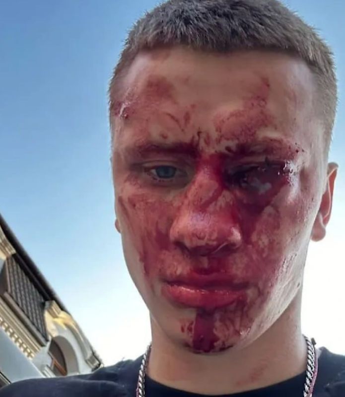 Известный боксер лишился глаза, заступившись за подростка в Феодосии — 15 агрессоров избивали его толпой, Дмитрий Двали бросился на помощь Известный боксер лишился глаза, заступившись за подростка в Феодосии — 15 агрессоров избивали его толпой, Дмитрий Двали бросился на помощь