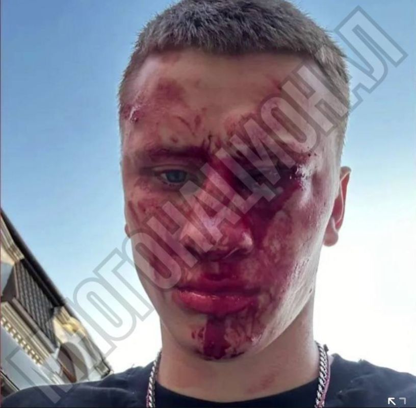 Чемпион России и Европы по боксу Дмитрий Двали лишился глаза, заступившись за мальчика, которого избивала многонациональная банда в Феодосии Чемпион России и Европы по боксу Дмитрий Двали лишился глаза, заступившись за мальчика, которого избивала многонациональная банда в Феодосии