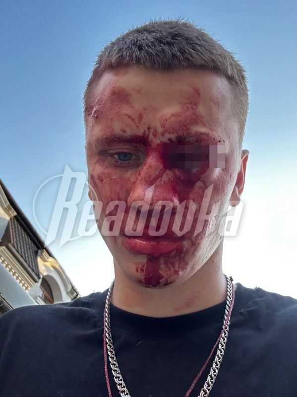 � �������� �������� ������ � ������ �� ����� ������ ���� � �� ���� ������ ����� 15 ������ ��-�� ����, ��� �� ���������� �� ���������, � ������ ��������� ��������� �������� ��������� ���������� � ��� �����