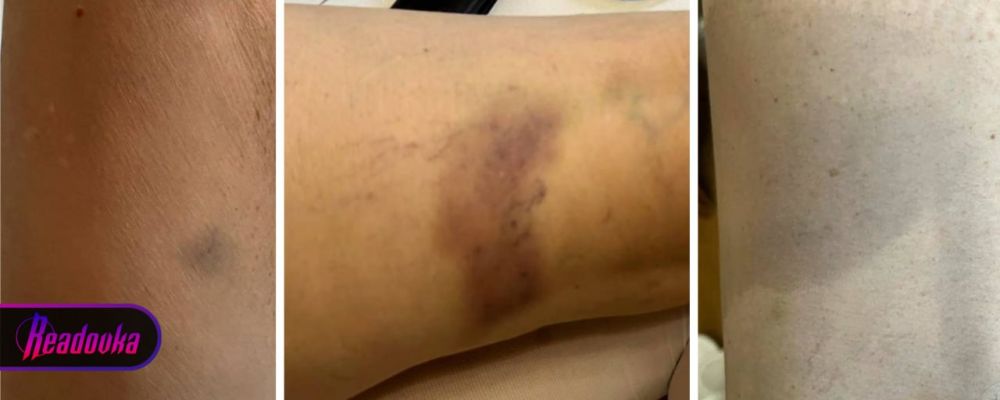 В фирменном поезде «Таврия» пьяный мужчина избил пенсионерку-инвалида, назвал крымчан «хохлами» и пригрозил отнять у них бизнес В фирменном поезде «Таврия» пьяный мужчина избил пенсионерку-инвалида, назвал крымчан «хохлами» и пригрозил отнять у них бизнес