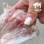 Симферопольские врачи не смогли пришить оторванный палец слесарю, потому что у них не оказалось нужной аппаратуры