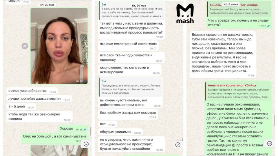 Самый дешёвый косметолог Астаны сделала лицо-грушу 33-летней крымчанке Самый дешёвый косметолог Астаны сделала лицо-грушу 33-летней крымчанке