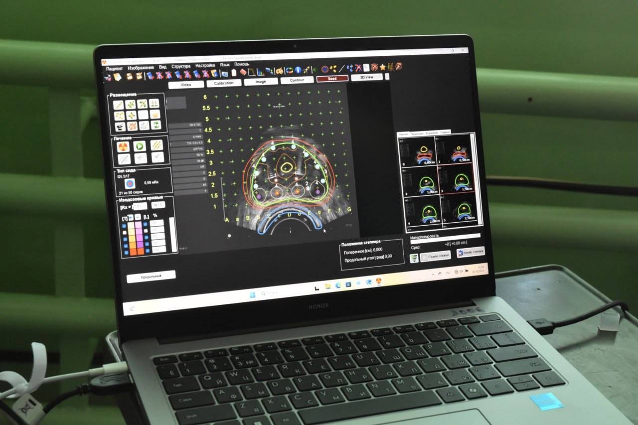 В КРОКД им. В.М. Ефетова приобретено оборудование для проведения брахитерапии предстательной железы