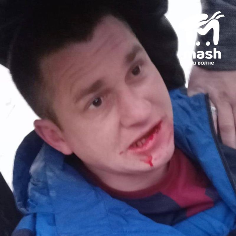 Новый директор АО "Крымэкоресурсы" избил подчинённого за жалобу на жёсткий график работы Новый директор АО "Крымэкоресурсы" избил подчинённого за жалобу на жёсткий график работы