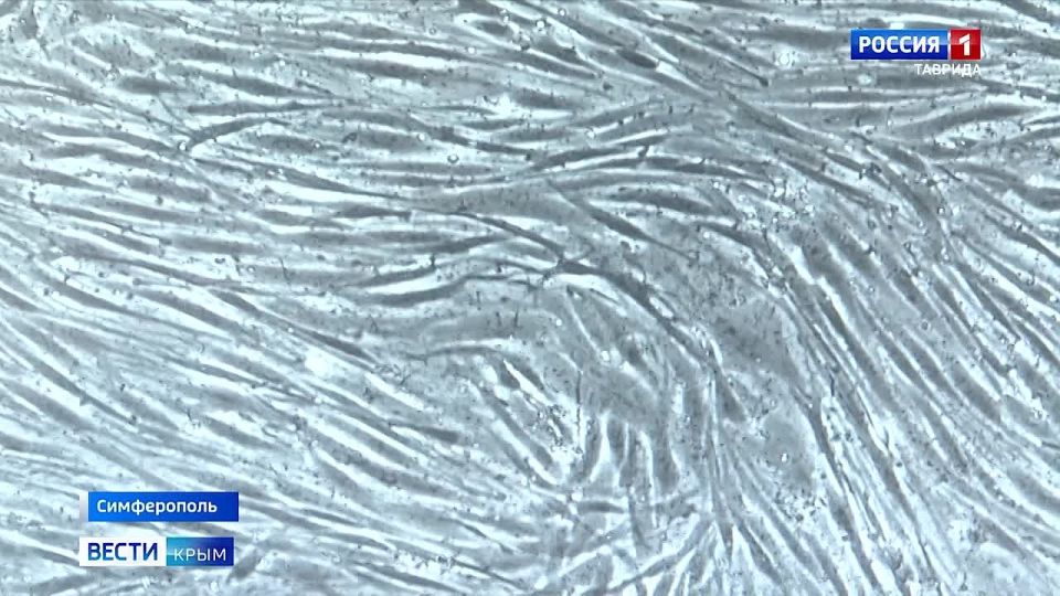 Крымские ученые тестируют инновационный пластырь, который помогает в регенерации клеток кожи