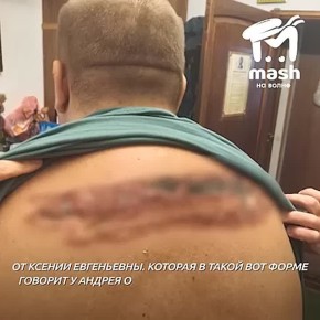 Инвалид получил ожоги в психоневрологическом диспансере в Ялте