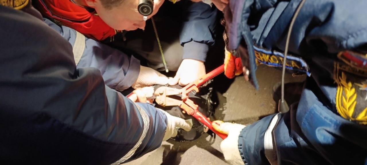 Крымские спасатели вызволили пальцы ребенка из металлической ловушки