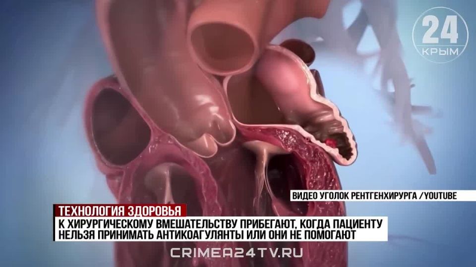 ��������� ����� ������� ������� �������� �� ������ � �������������� ���������