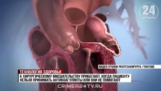 ��������� ����� ������� ������� �������� �� ������ � �������������� ���������