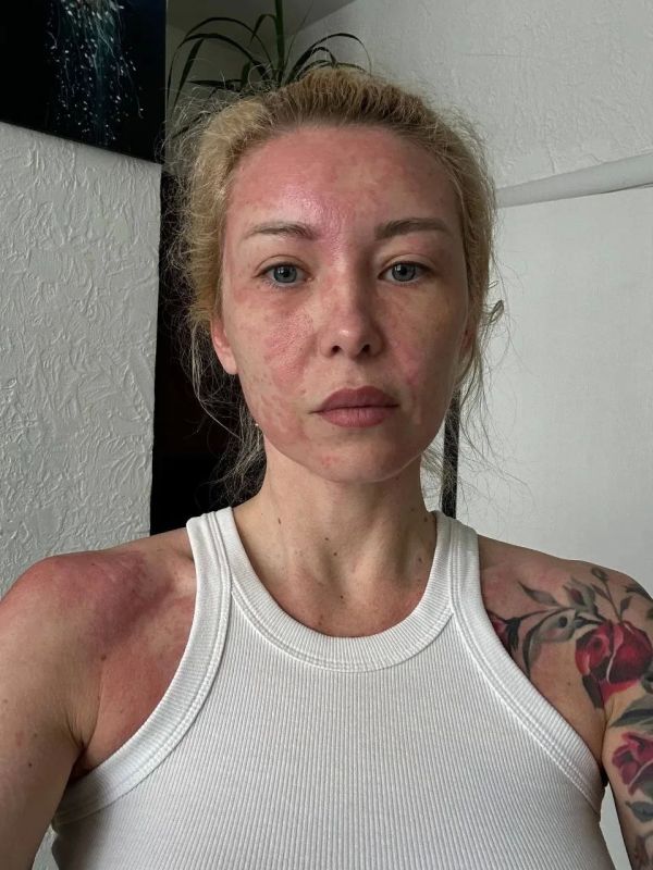 Екатерине Запашной, которая попала в реанимацию в Севастополе, стало лучше Екатерине Запашной, которая попала в реанимацию в Севастополе, стало лучше