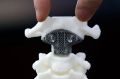 В Крыму впервые установили 3D-печатный имплант вместо сустава